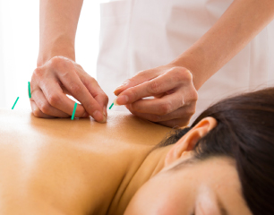 お一人おひとりに合わせた施術